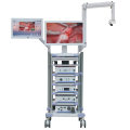 Medical Hospital Camera System Laparoscopic Complete Set Endoscopic Tower for Gallbladder Surgery